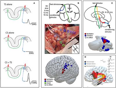 Novel Asleep Techniques for Intraoperative Assessment of Brain Connectivity